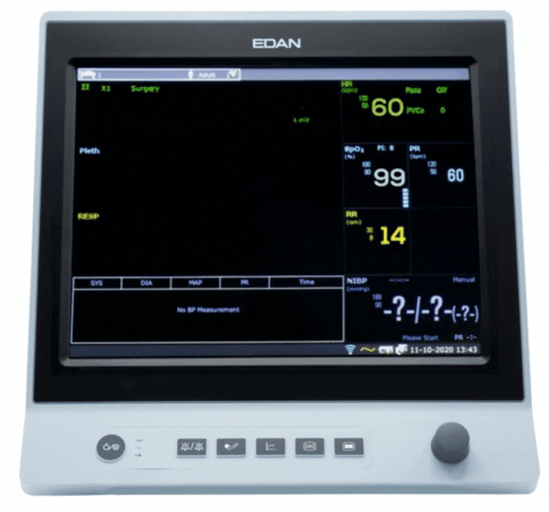 جهاز مراقبة بيطري Edan X10