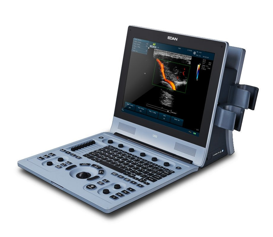 EDAN-U60 Vet Diagnostic Ultrasound System