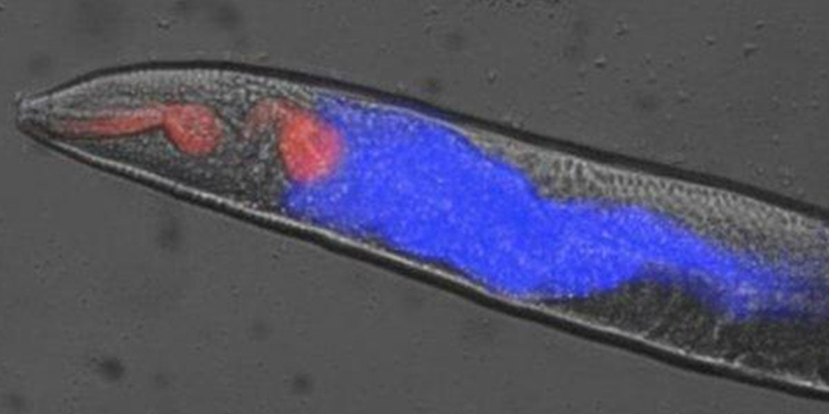 This Discovery of Bizarre Dying Mechanism in Worms Could Help Us Cheat Death