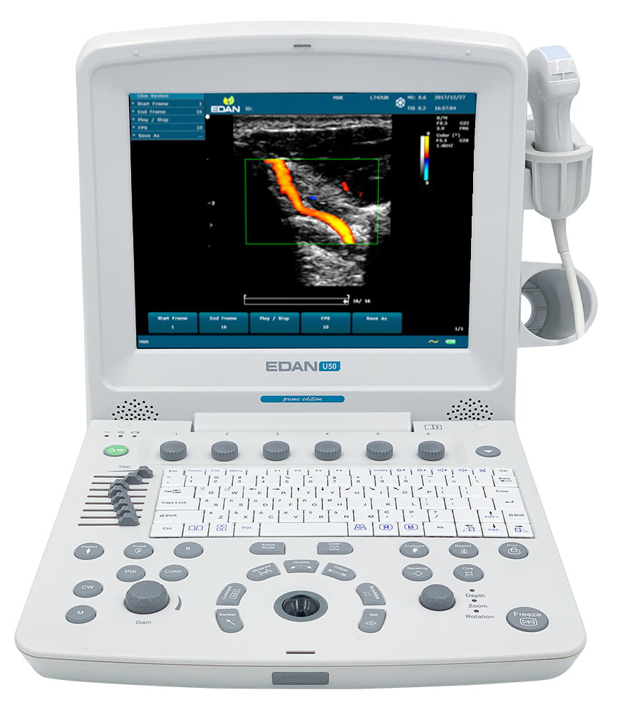 EDAN-U50 VET Diagnostic Ultrasound
